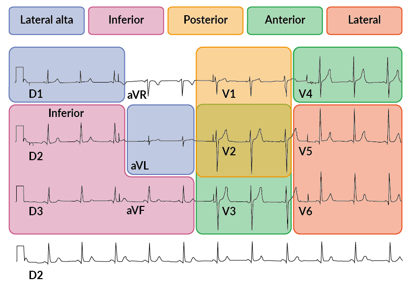 eletrocardiograma